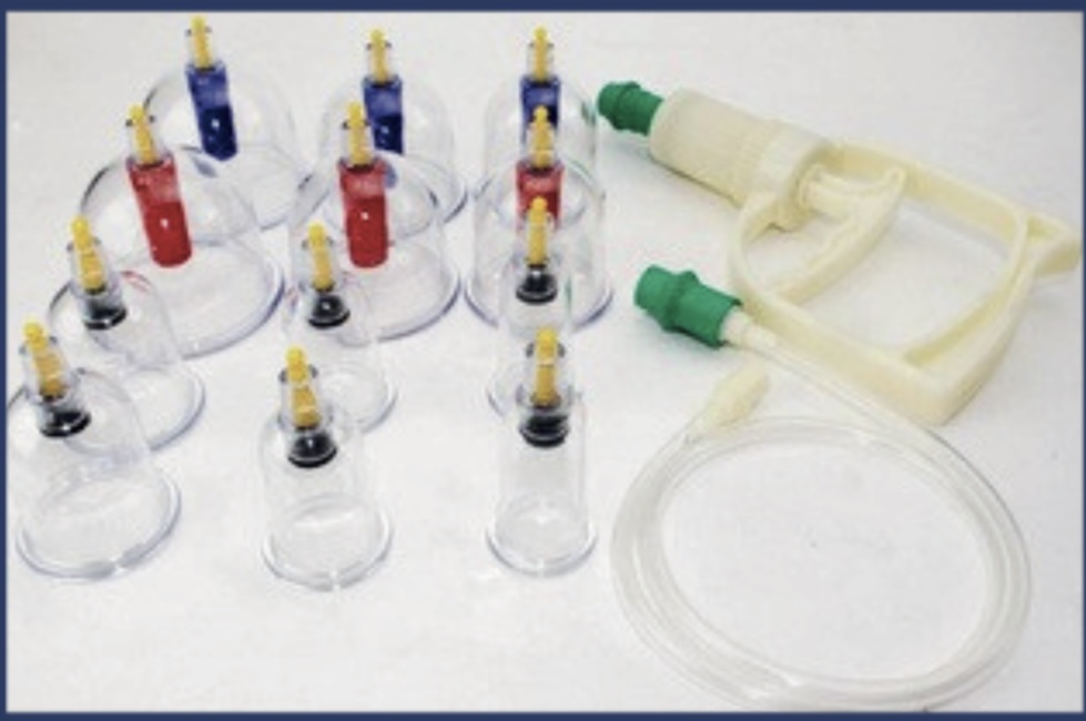 Vacuum Cupping Set of Twelve — Scanda Enterprises, medical supplies Moosapet Hyderabad
